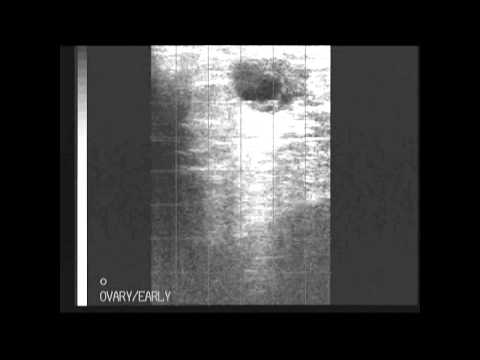 BCF Technology Ultrasonography of the bovine reproductive tract video 8 - Ultrasound clip
